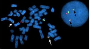 Hibridaci N In Situ Fluorescente Fish Cibic Laboratorios